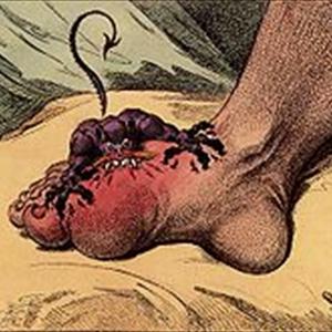 Treatment For Gout - Herbal Cure For Gout - What You Should Incorporate Into Your Treatment